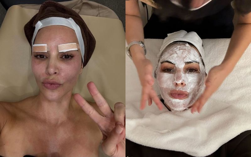 킴 카다시안 한남동 피부과 K뷰티 의료관광 서울